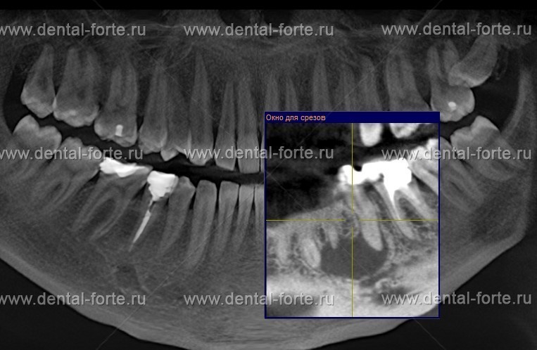 Лечение периостита Томск Героев Чубаровцев набережная реки ушайки 8 стоматология томск
