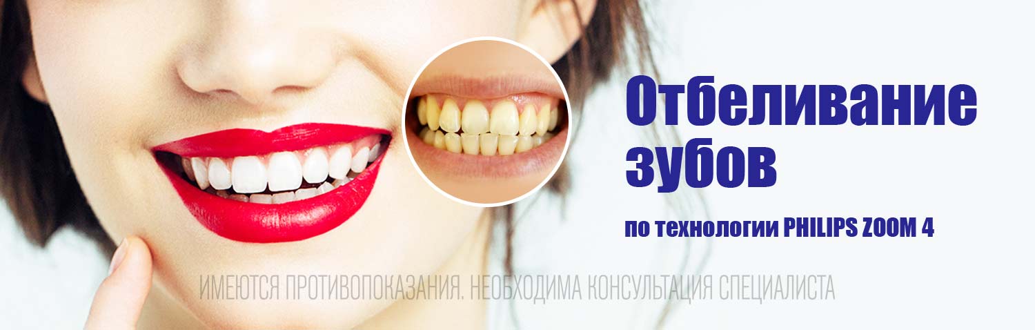 Стоматология Набережные Челны - DENTAL FORTE "Дентал Форте"